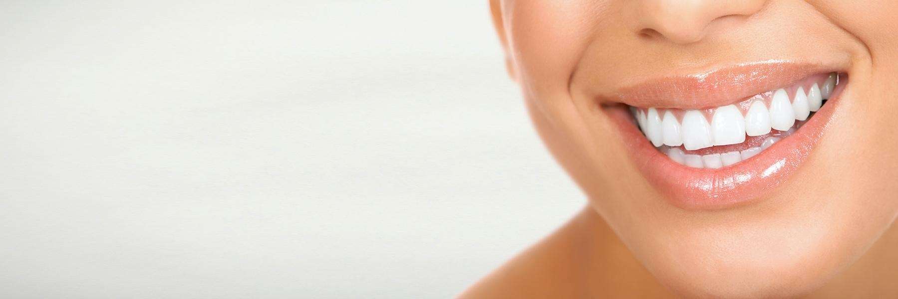 Sleep Dentistry for Cosmetic Veneers | Dentist